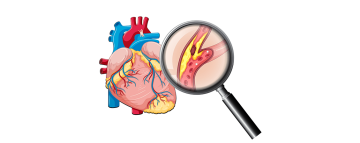 Ovlivnění dyslipidemie v prevenci kardiovaskulárních onemocnění