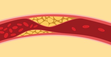 Nová konkurence na trhu látek snižujících hladinu LDL